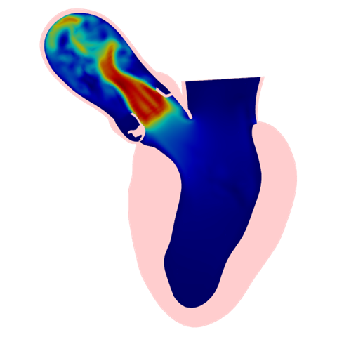 Abaqus FSI results snippet